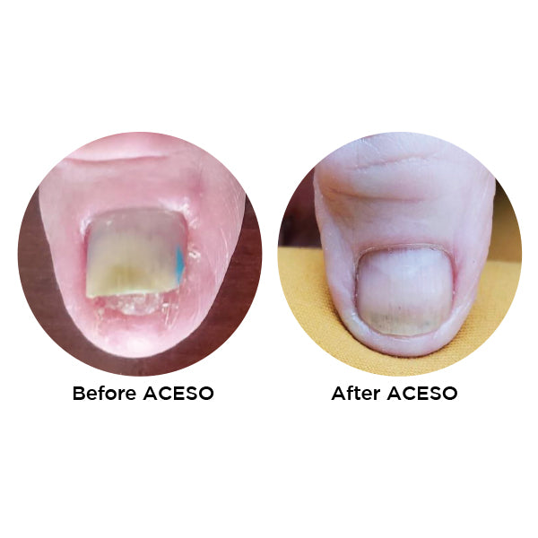 Aceso Client Kit
